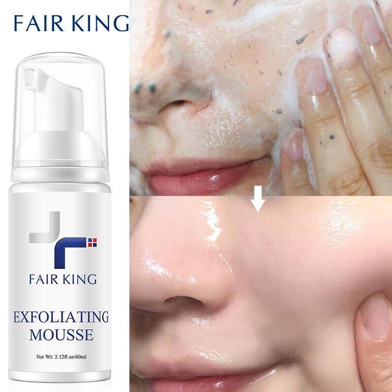 Foaming Exfoliating Mousse Deep Remove Cleaning Smooth Moisturizing Skin Exfoliator Unblock Pores - acfitpro