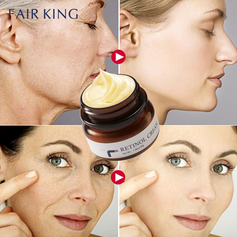 Retinol Cream Anti-Aging Wrinkle Lightening Whitening Spots Accelerated Skin Renewal and Vitamin A Cream - acfitpro